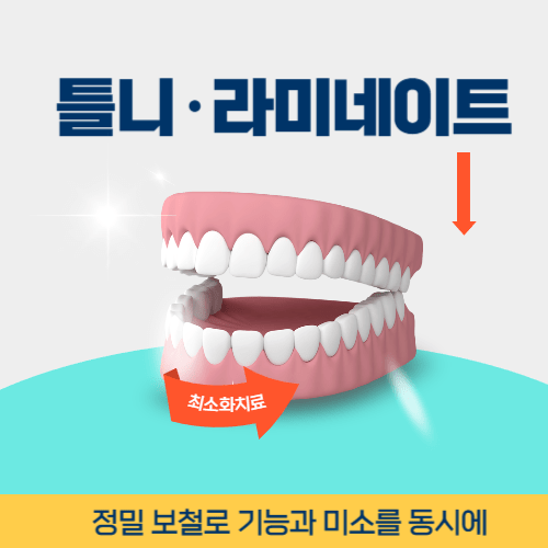 고양치과 고양시 치과 틀니 라미네이트