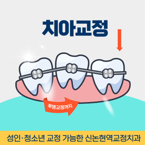 고양치과 고양시 치과 치아교정