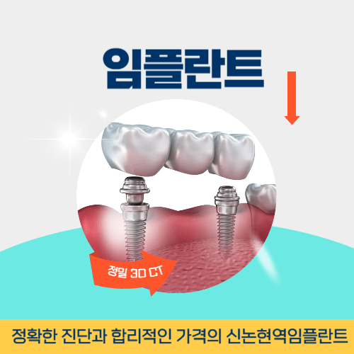 고양치과 고양시 치과 임플란트