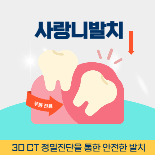 고양치과 고양시 치과 사랑니 발치