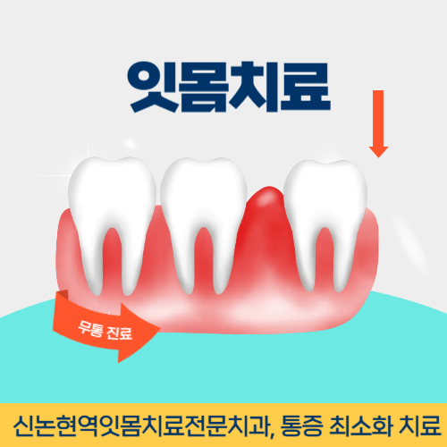 고양치과 고양시 치과 잇몸치료